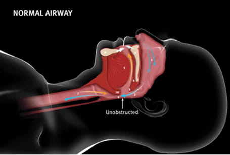 Normal Airway